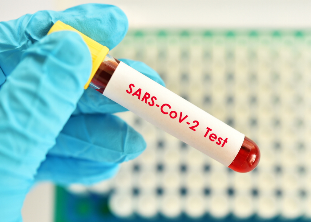 SARS-CoV-2